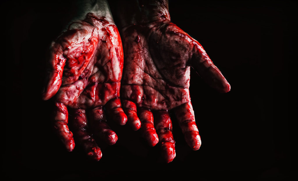 Bloody hands.